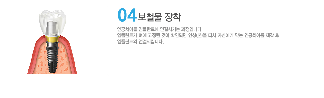 4. ö 
 ΰġƸ öƮ Ű Դϴ. öƮ    ȮεǸ   ڽſ ° ۵ ΰġƸ ŵϴ.
