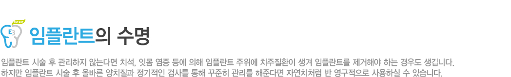 < öƮ  >

öƮ ü   ʴ´ٸ ġ, ո    öƮ  ġȯ  öƮ ؾ ϴ 쵵 ϴ. 
 öƮ ü  ùٸ ġ  ˻縦    شٸ ڿġó   Ͻ  ֽϴ.