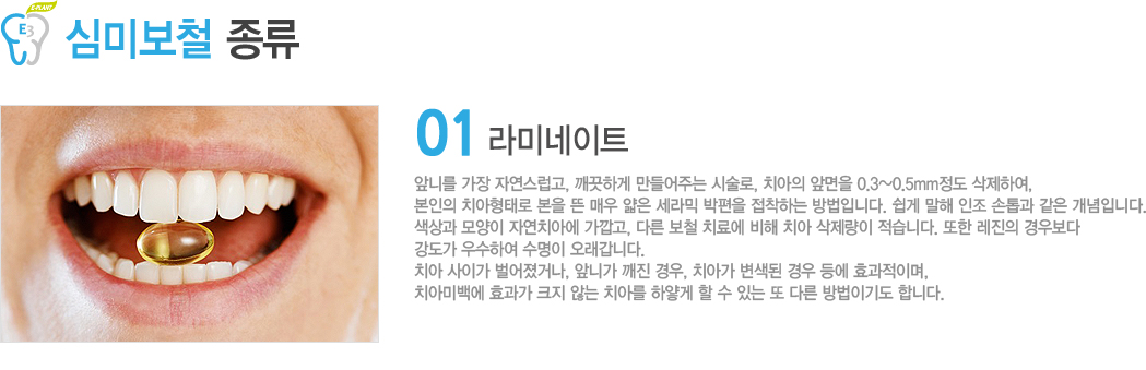 ̳Ʈ
մϸ  ڿ, ϰ ִ ü, ġ ո 0.3~0.5mm Ͽ,  ġ·   ſ    ϴ Դϴ.      Դϴ. 
  ڿġƿ , ٸ ö ġῡ  ġ  ϴ.   캸  Ͽ  ϴ.
ġ ̰ ų, մϰ  , ġư    ȿ̸, 
ġƹ̹鿡 ȿ ũ ʴ ġƸ Ͼ   ִ  ٸ ̱⵵ մϴ.